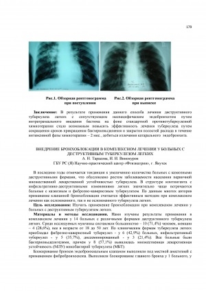 Обложка Электронного документа: Внедрение бронхоблокации в комплексном лечении у больных с деструктивным туберкулезом легких