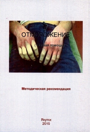 Обложка Электронного документа: Отморожение (первая помощь): методическая рекомендация